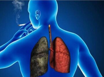 Con la estrategia del Caballo de Troya, luchan contra cáncer pulmonar