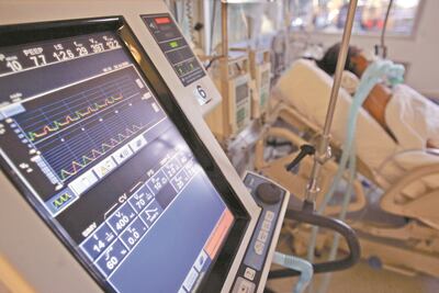 Confirman compra de Salud capitalina de respiradores alemanes