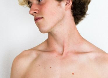 Amanece con un bulto en el hombro, fue al médico y el diagnóstico fue devastador