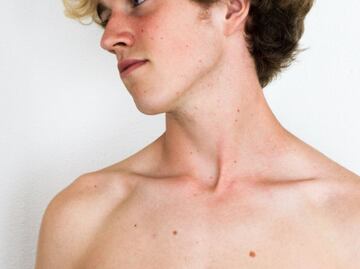 Amanece con un bulto en el hombro, fue al médico y el diagnóstico fue devastador