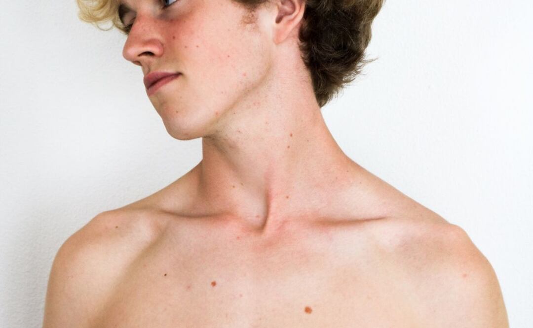 Hombro. Fuente: Pexels