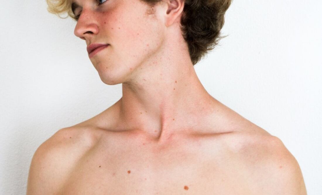 Hombro. Fuente: Pexels