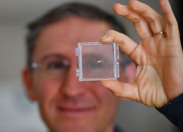 Insertan microrobots en el cráneo para curar enfermedades cerebrales