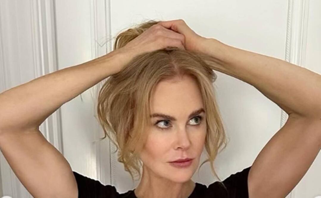 Nicole Kidman pretendía dar a conocer una causa benéfica en sus redes, pero su aspecto desvió los comentarios de sus seguidores.