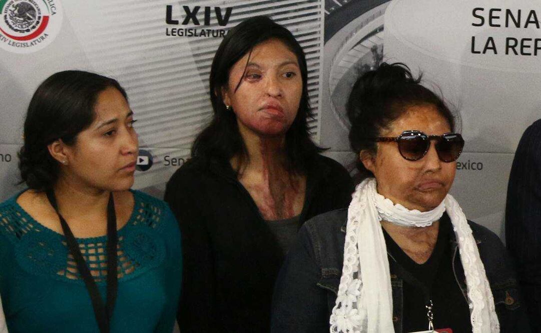Los ataques con ácido causan dolor agudo, desfiguración permanente, ceguera e infecciones en las mujeres