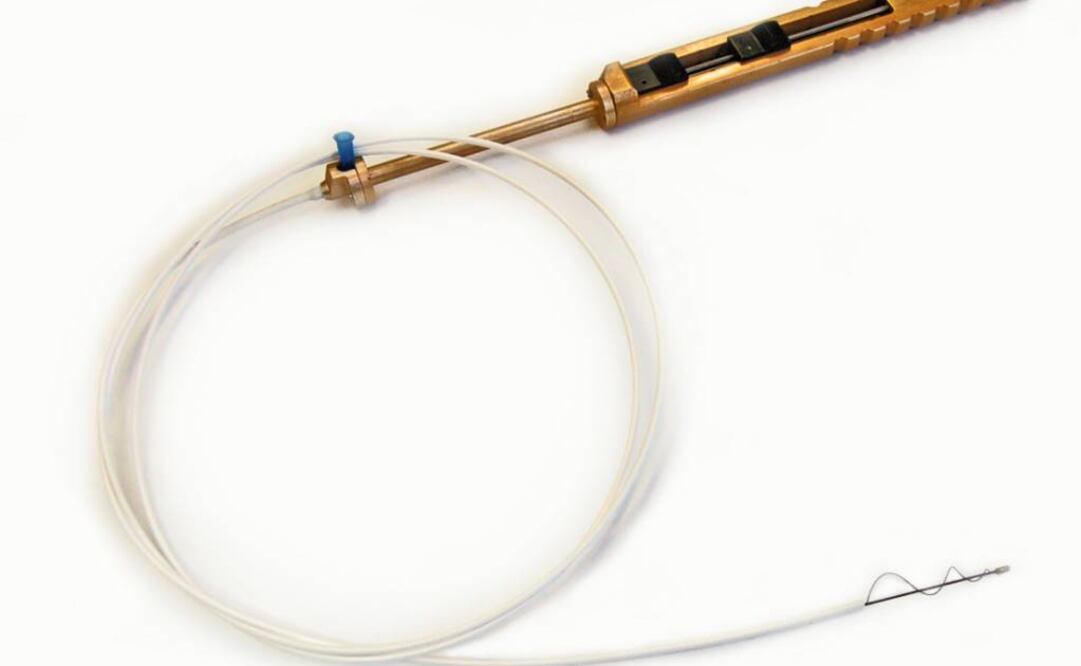 El extractor superelástico "trawl", que permite agarrar y extraer rápidamente objetos extraños de órganos huecos y estructuras tubulares del cuerpo humano. (FOTO: EFE)