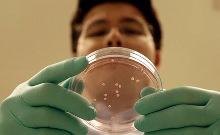 Cultivan partes de cerebro humano para estudios