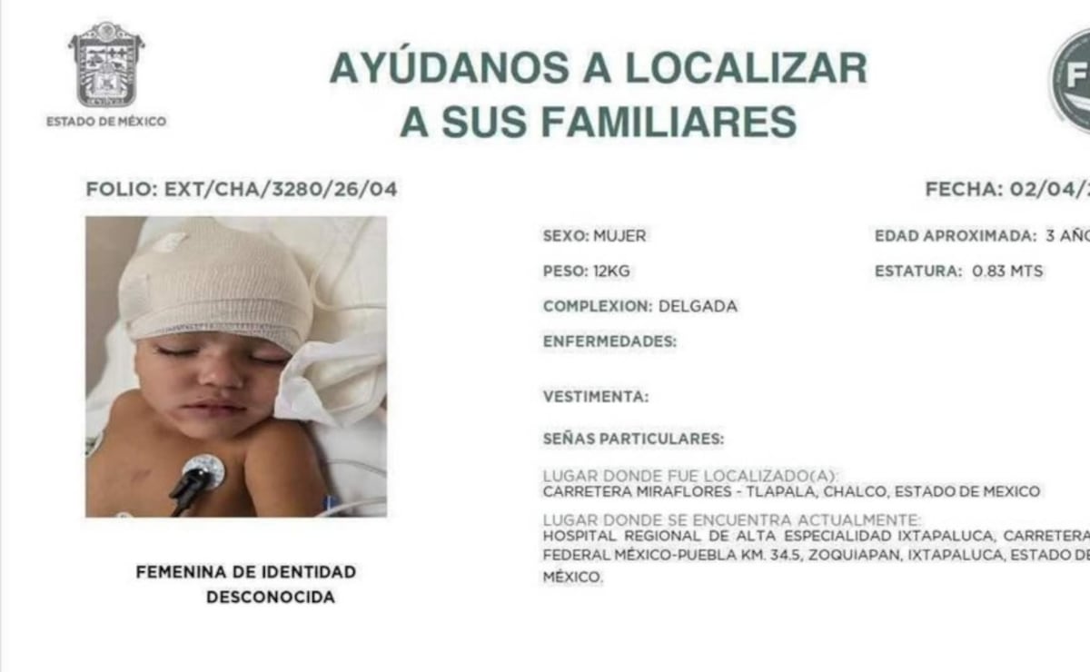 Identifican a niña de 3 años herida en accidente de Chalco