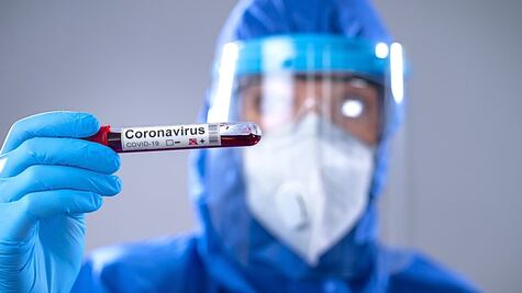 Plasma convaleciente, el tratamiento experimental que investigan contra Covid-19