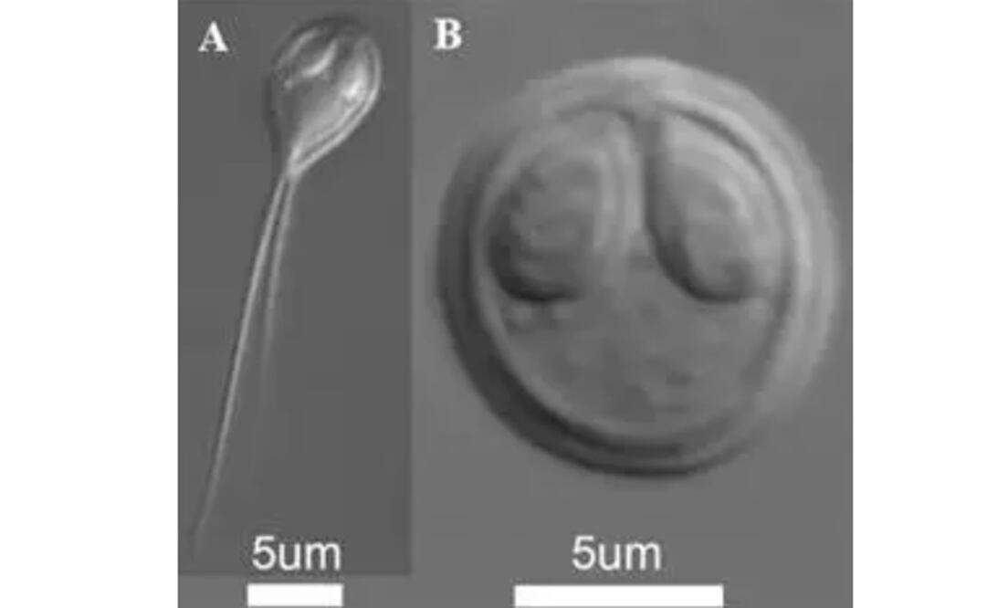 Mixosporas de los dos parásitos mixozoarios estudiados. A. Henneguya salminicola, B. Myxobolus squamalis. Foto: Stephen D. Atkinson Et Al. /PNAS vía Europa Press