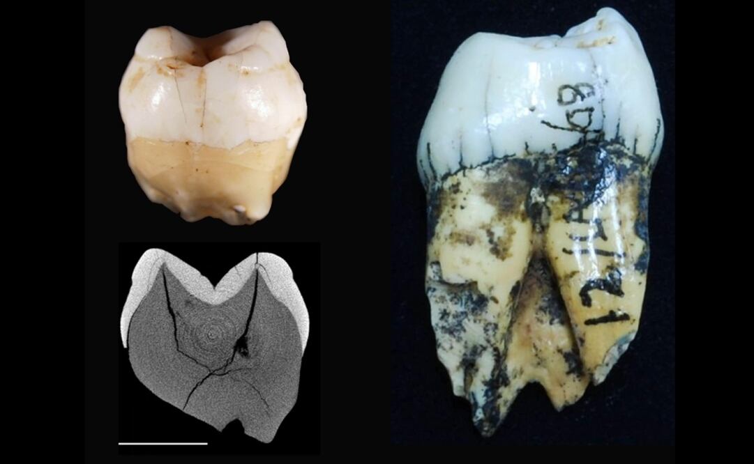 Un diente de un ser humano actual (arriba, i), con su correspondiente imagen escaneada (debajo, i) comparados con el diente de un orangután (d). Foto: EFE / Universidad Macquaire