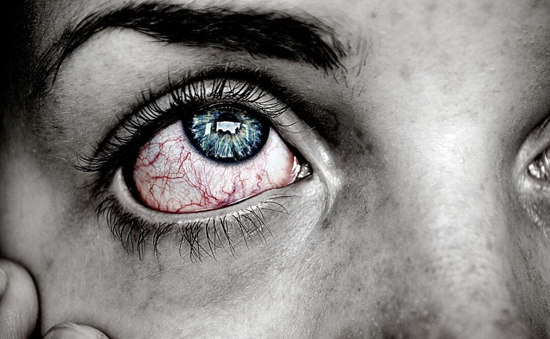 Tanta belleza puede hacer daño a algunas personas. Imagen: Pixabay