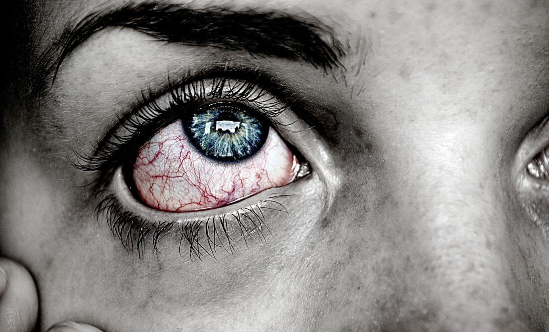 Tanta belleza puede hacer daño a algunas personas. Imagen: Pixabay