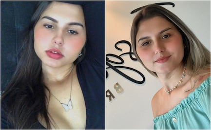 Gemelas trans se someten juntas a cirugía de reasignación de género en Brasil