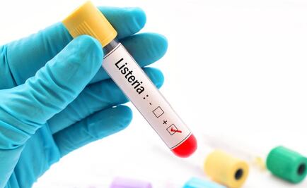Listeria: por qué es tan peligrosa la infección por esta bacteria