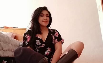 IMSS atiende recomendación en caso de mujer que le amputaron las piernas; reconoce compensación