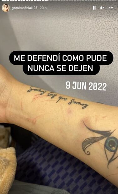 Gomita denuncia públicamente a su expareja por haberla golpeado: "Me defendí como pude"