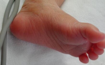 Dan 20 años de cárcel a mujer que dejó morir de hambre a su bebé de 11 meses en Sinaloa