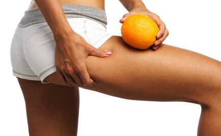 5 Alimentos que evitan la celulitis