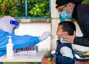 Investigación de The Lancet vincula casos de hepatitis infantil aguda con el Covid-19