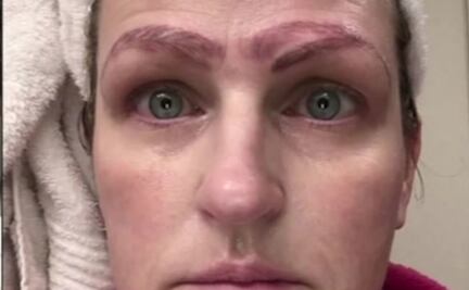 Mujer se hace microblading y le dibujan cuatro cejas