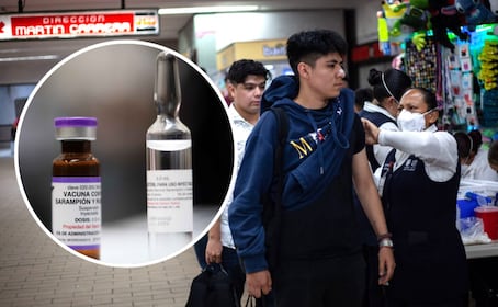 ¿Quiénes no deben vacunarse contra el sarampión y por qué?