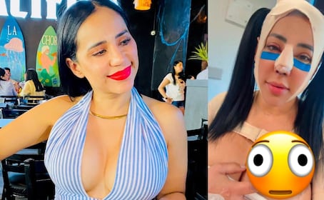 ¿Se tuneó todita? Sandra Cuevas habría aprovechado rino para ponerse más busto 