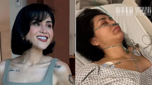 ¡Impactante reaparición! Gomita vuelve tras cirugía de emergencia y preocupa por su aspecto "