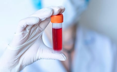 ¿Necesitas estudios clínicos? FES Cuautitlán ofrece opciones a bajo costo