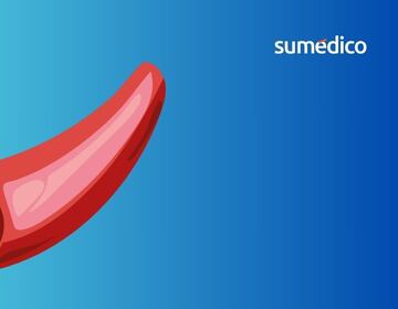 Crean vasos sanguíneos con apoyo de la IA ¿cuáles serán los beneficios?