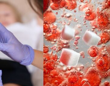 Picazón en los pies por diabetes: causas, tratamiento y productos recomendados