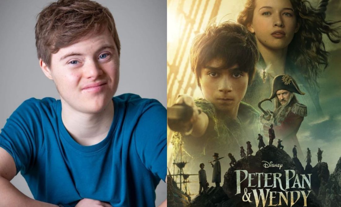 Disney: Actor con síndrome de down protagoniza live action de “Peter Pan & Wendy”