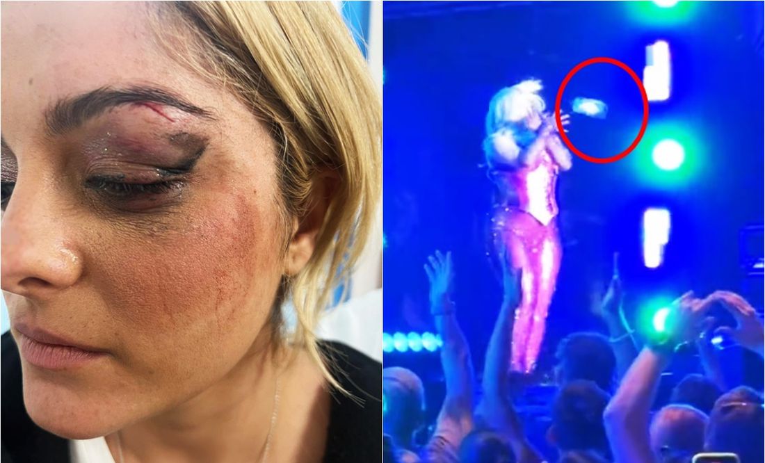 Bebe Rexha sufrió un accidente arriba del escenario, luego de que recibir un golpe con un celular.
Fotos: Instagram e Twitter