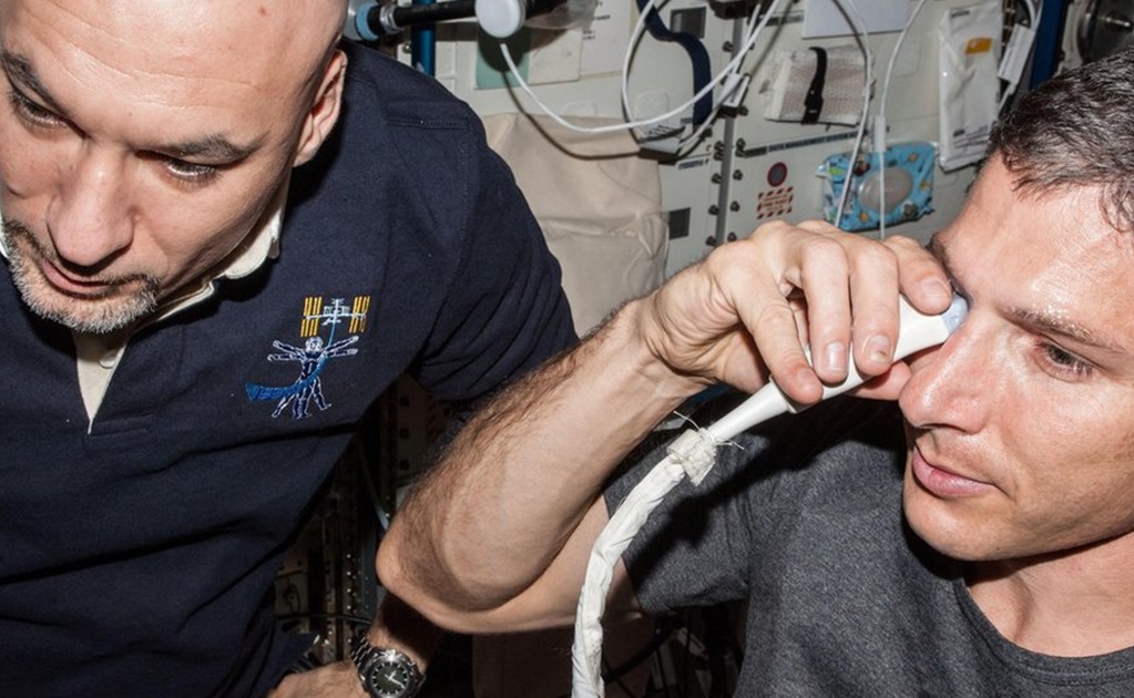¿Por qué los astronautas sufren problemas de visión?