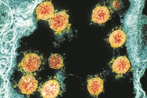 Photo of El coronavirus puede invadir y replicarse en el cerebro: un estudio