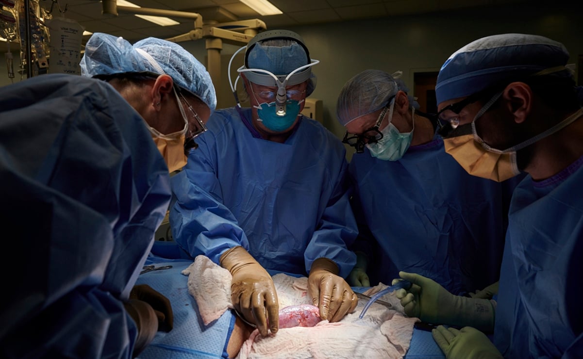 Trasplantan un riñón de cerdo a una mujer con muerte cerebral en EU