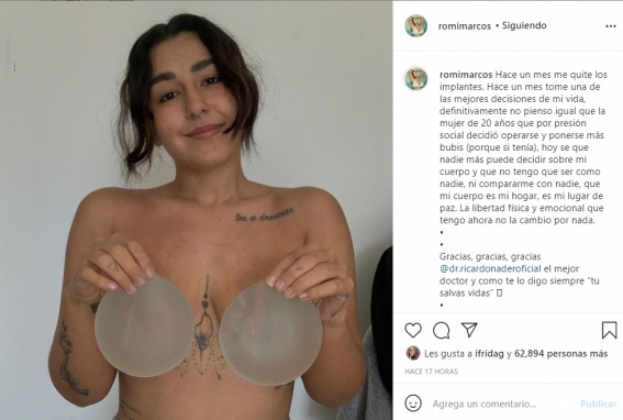 romina marcos implantes - Romina, hija de Niurka, se quita los implantes de senos