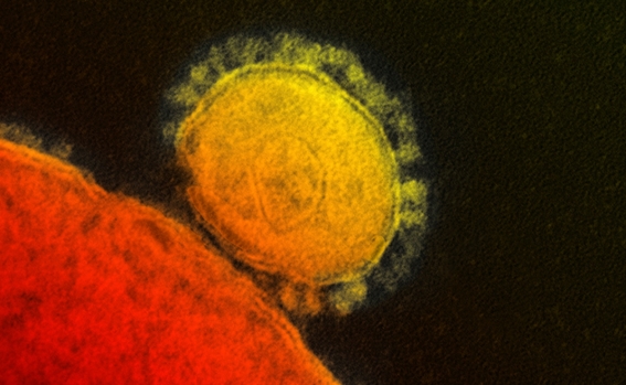 coronavirus_covid_19_microscopio_i1.jpg